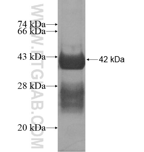 SLC39A7 fusion protein Ag13762 SDS-PAGE