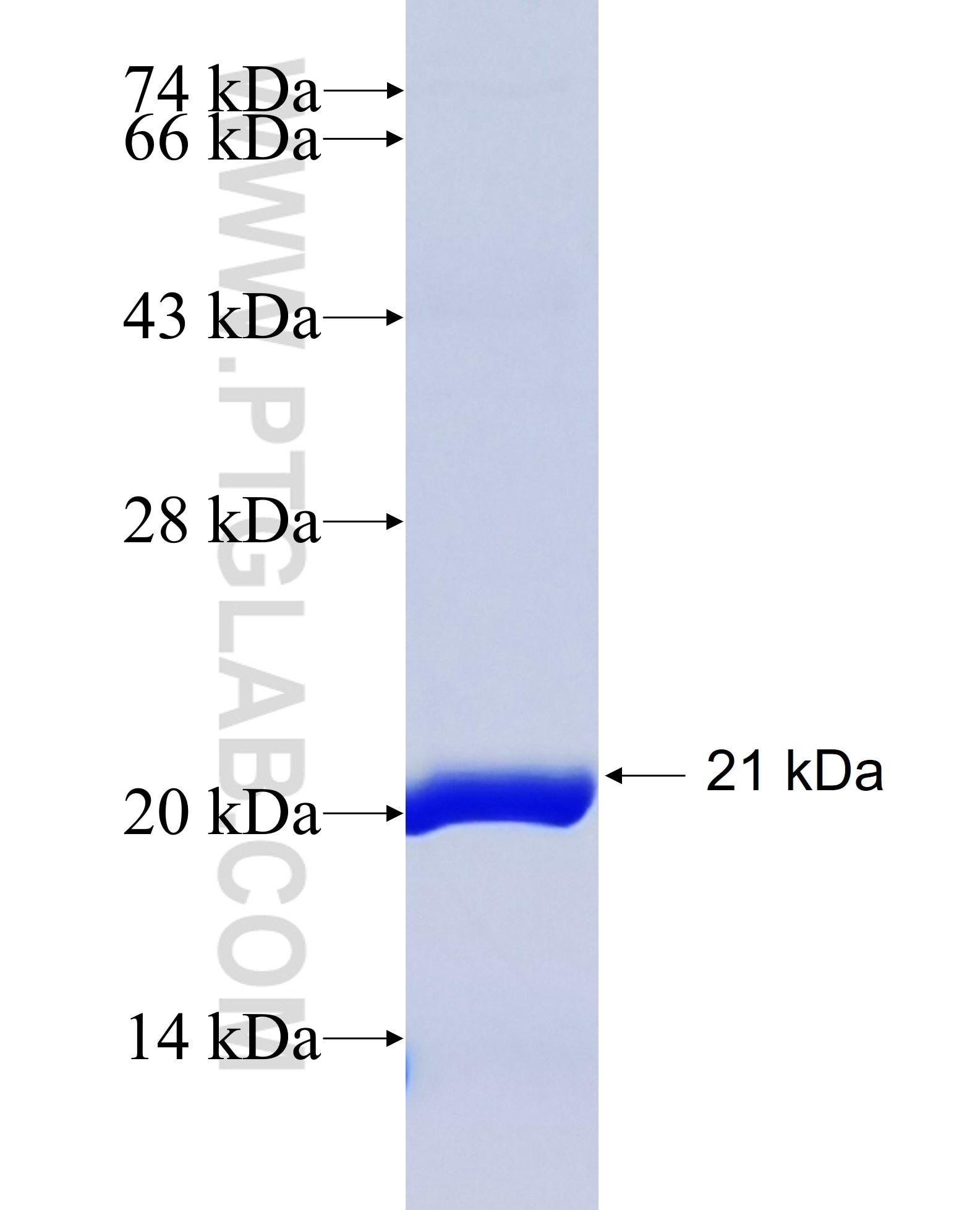 SLC39A7 fusion protein Ag13798 SDS-PAGE