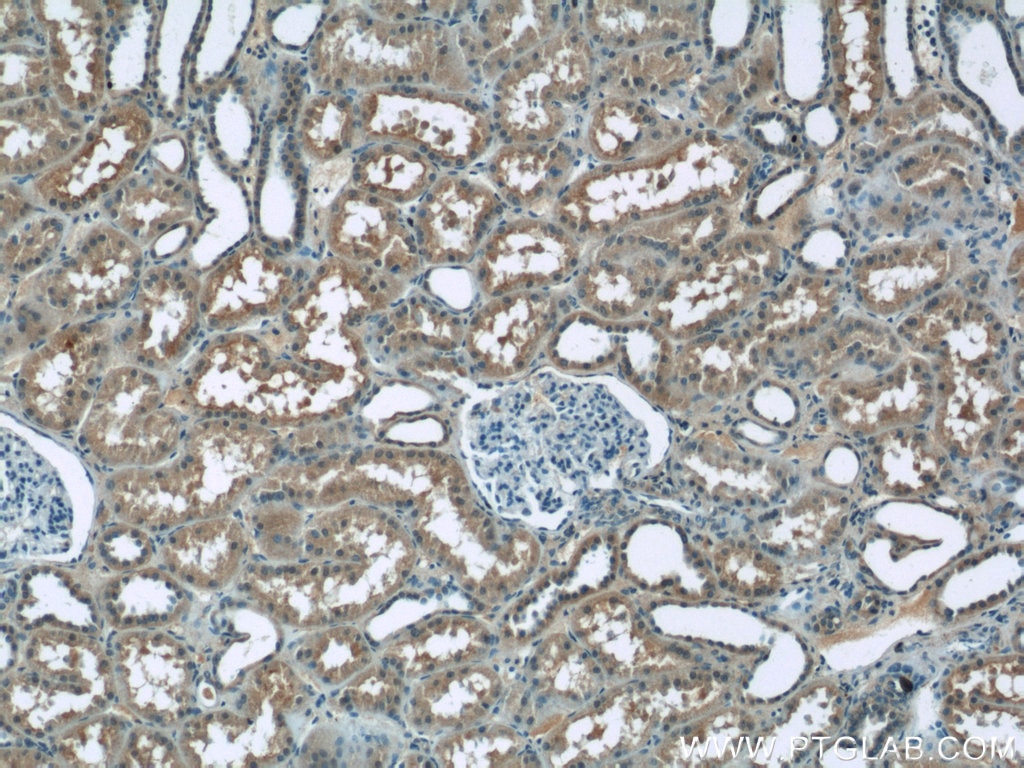 Immunohistochemistry (IHC) staining of human kidney tissue using ZIP8 Polyclonal antibody (20459-1-AP)