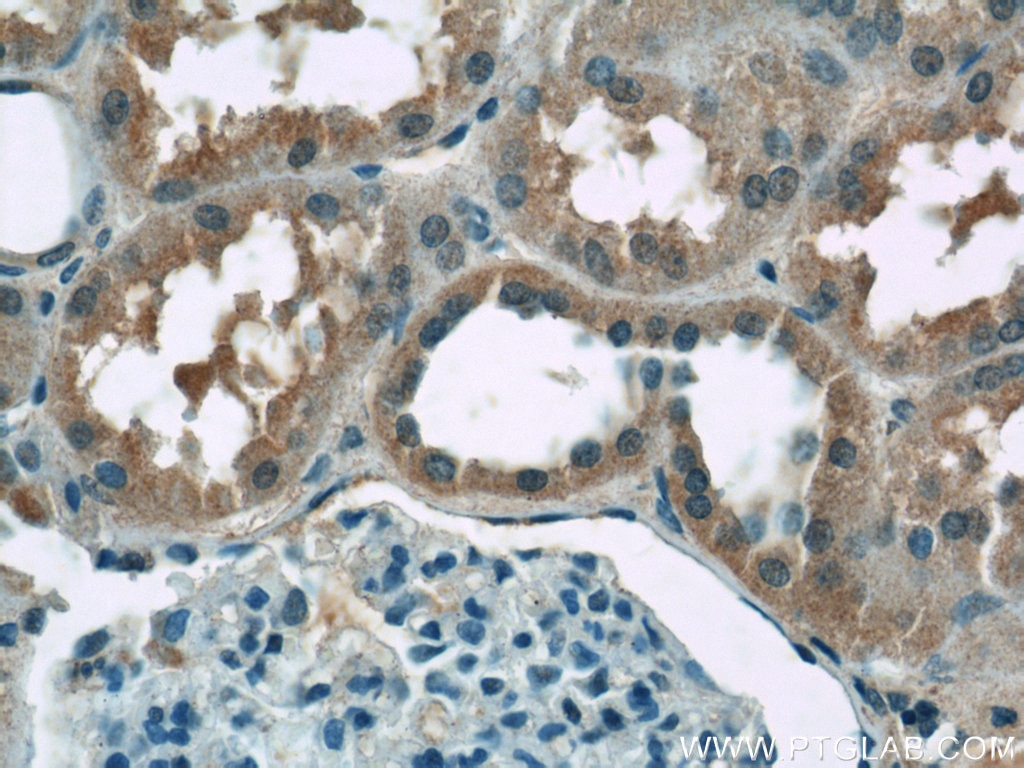 Immunohistochemistry (IHC) staining of human kidney tissue using ZIP8 Polyclonal antibody (20459-1-AP)