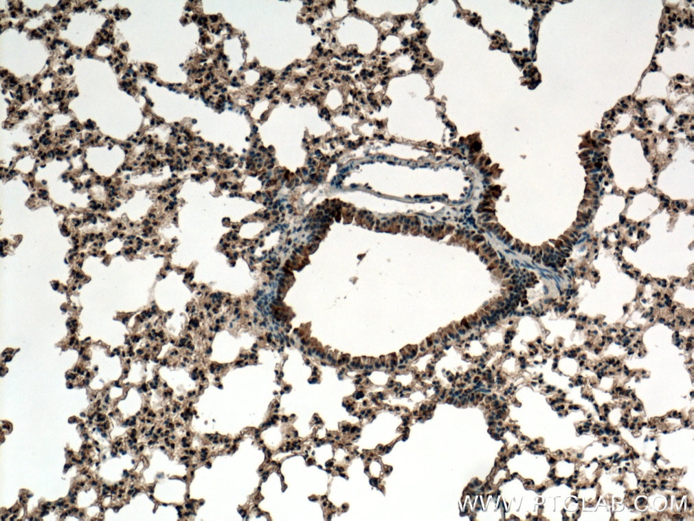 Immunohistochemistry (IHC) staining of mouse lung tissue using ZIP8 Polyclonal antibody (20459-1-AP)