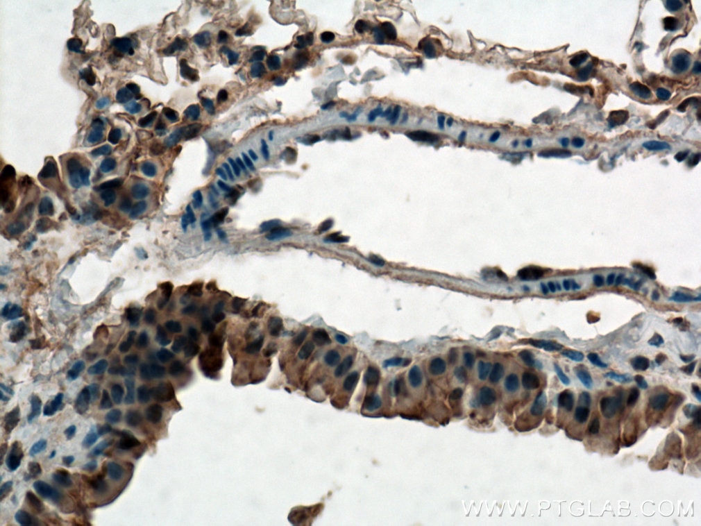 IHC staining of mouse lung using 20459-1-AP