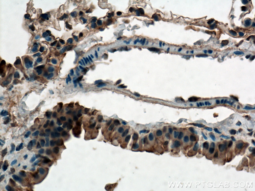 Immunohistochemistry (IHC) staining of mouse lung tissue using ZIP8 Polyclonal antibody (20459-1-AP)