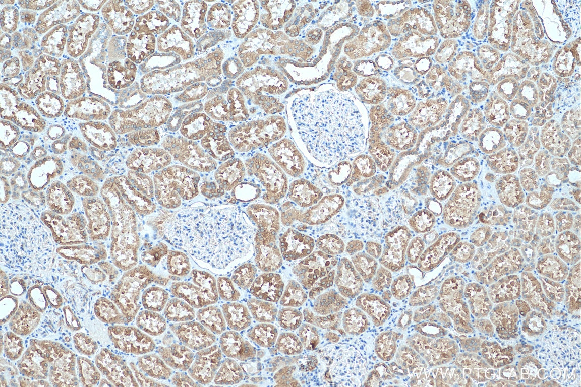 Immunohistochemistry (IHC) staining of human kidney tissue using ZIP8 Polyclonal antibody (20459-1-AP)