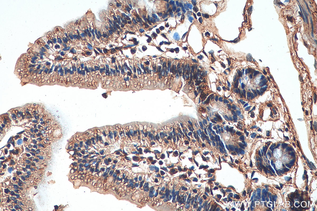 Immunohistochemistry (IHC) staining of mouse small intestine tissue using ZIP8 Polyclonal antibody (20459-1-AP)