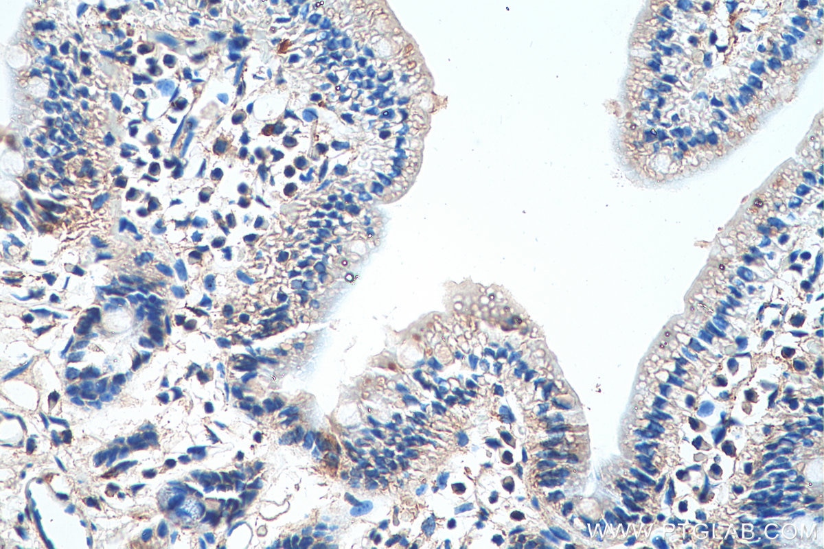 Immunohistochemistry (IHC) staining of mouse small intestine tissue using ZIP8 Polyclonal antibody (20459-1-AP)