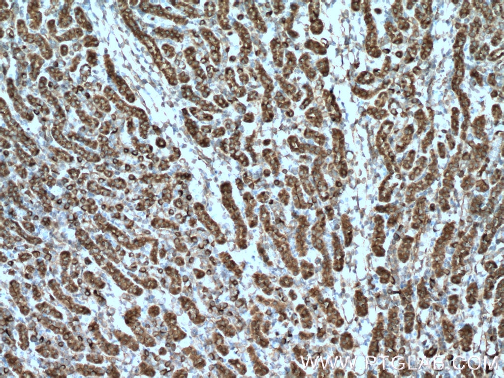 Immunohistochemistry (IHC) staining of mouse kidney tissue using ZIP8 Polyclonal antibody (20459-1-AP)