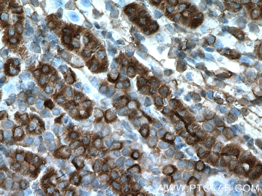 Immunohistochemistry (IHC) staining of mouse kidney tissue using ZIP8 Polyclonal antibody (20459-1-AP)