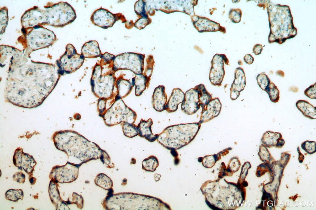Immunohistochemistry (IHC) staining of human placenta tissue using ZIP8 Polyclonal antibody (20459-1-AP)