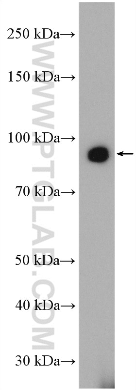 Western Blot (WB) analysis of mouse liver tissue using ZIP8 Polyclonal antibody (20459-1-AP)