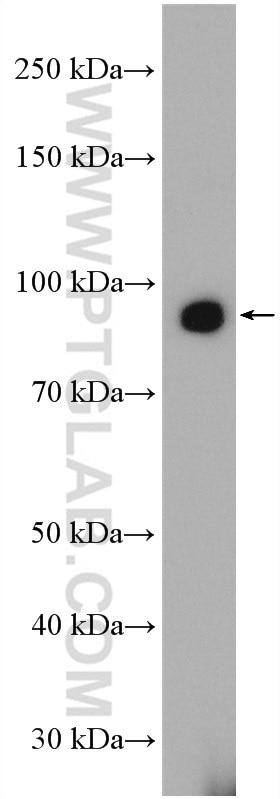 WB analysis of mouse liver using 20459-1-AP