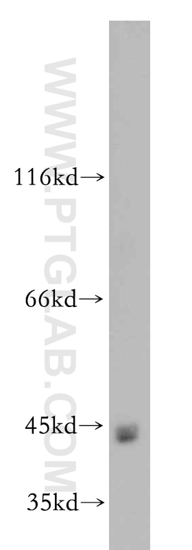 Western Blot (WB) analysis of mouse heart tissue using ZIP8 Polyclonal antibody (20459-1-AP)