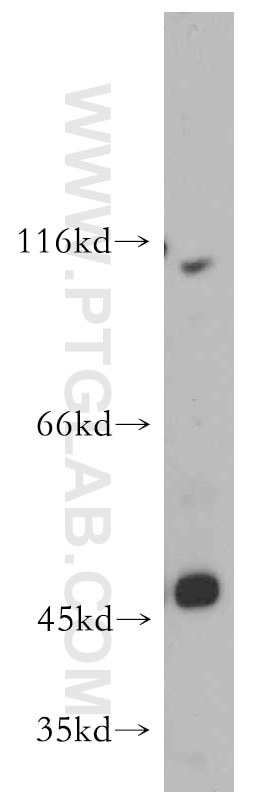 Western Blot (WB) analysis of mouse lung tissue using ZIP8 Polyclonal antibody (20459-1-AP)