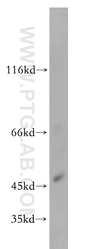 Western Blot (WB) analysis of U-937 cells using ZIP8 Polyclonal antibody (20459-1-AP)