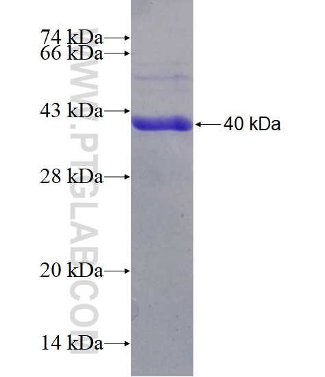 SLC39A8 fusion protein Ag14292 SDS-PAGE
