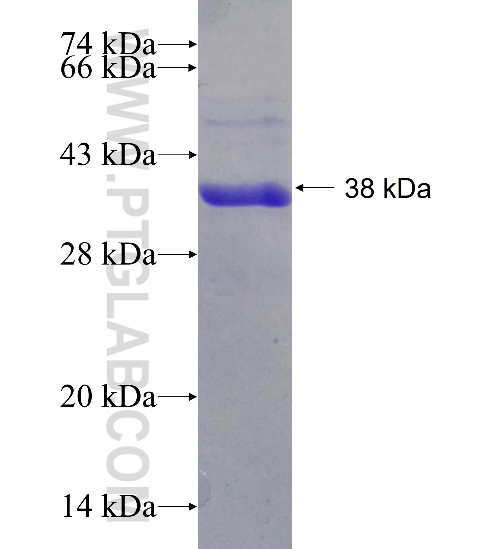 SLC39A8 fusion protein Ag14292 SDS-PAGE