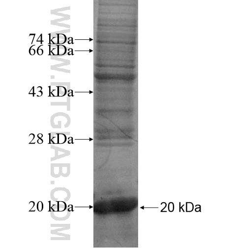 SLC39A8 fusion protein Ag14815 SDS-PAGE