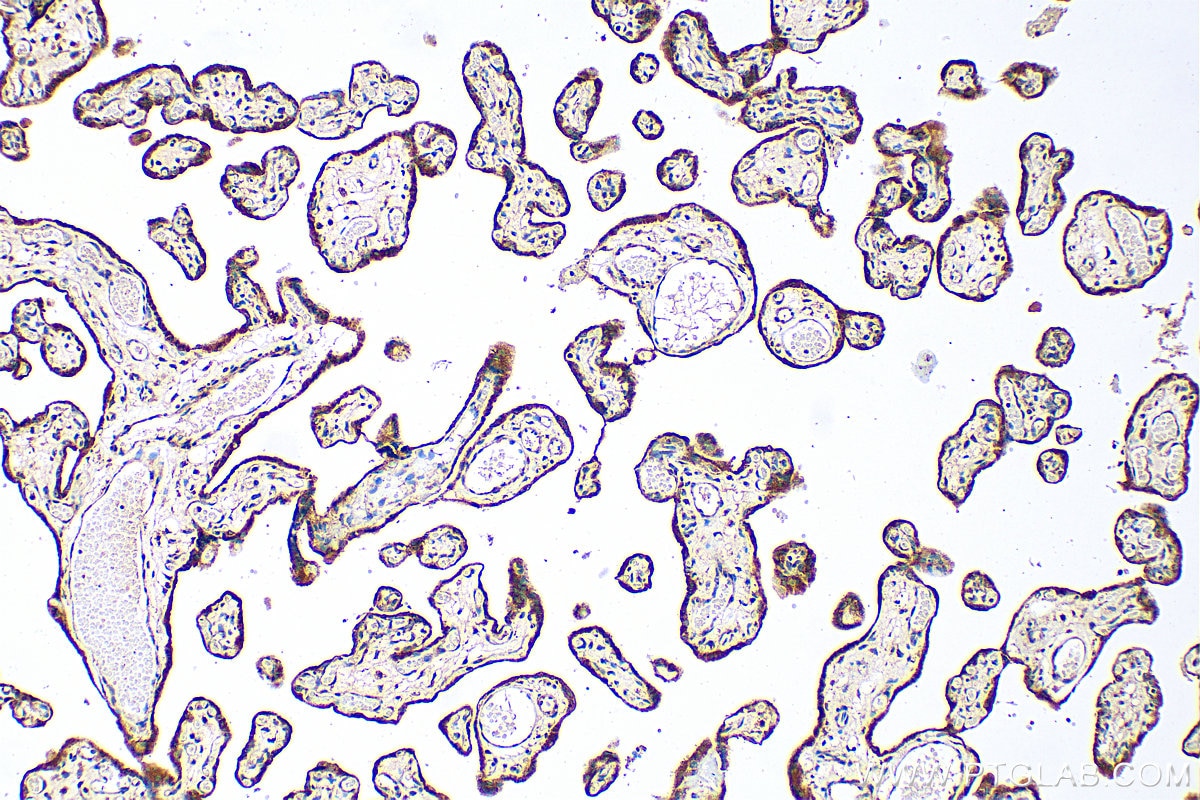 Immunohistochemistry (IHC) staining of human placenta tissue using SLC39A9 Polyclonal antibody (17607-1-AP)