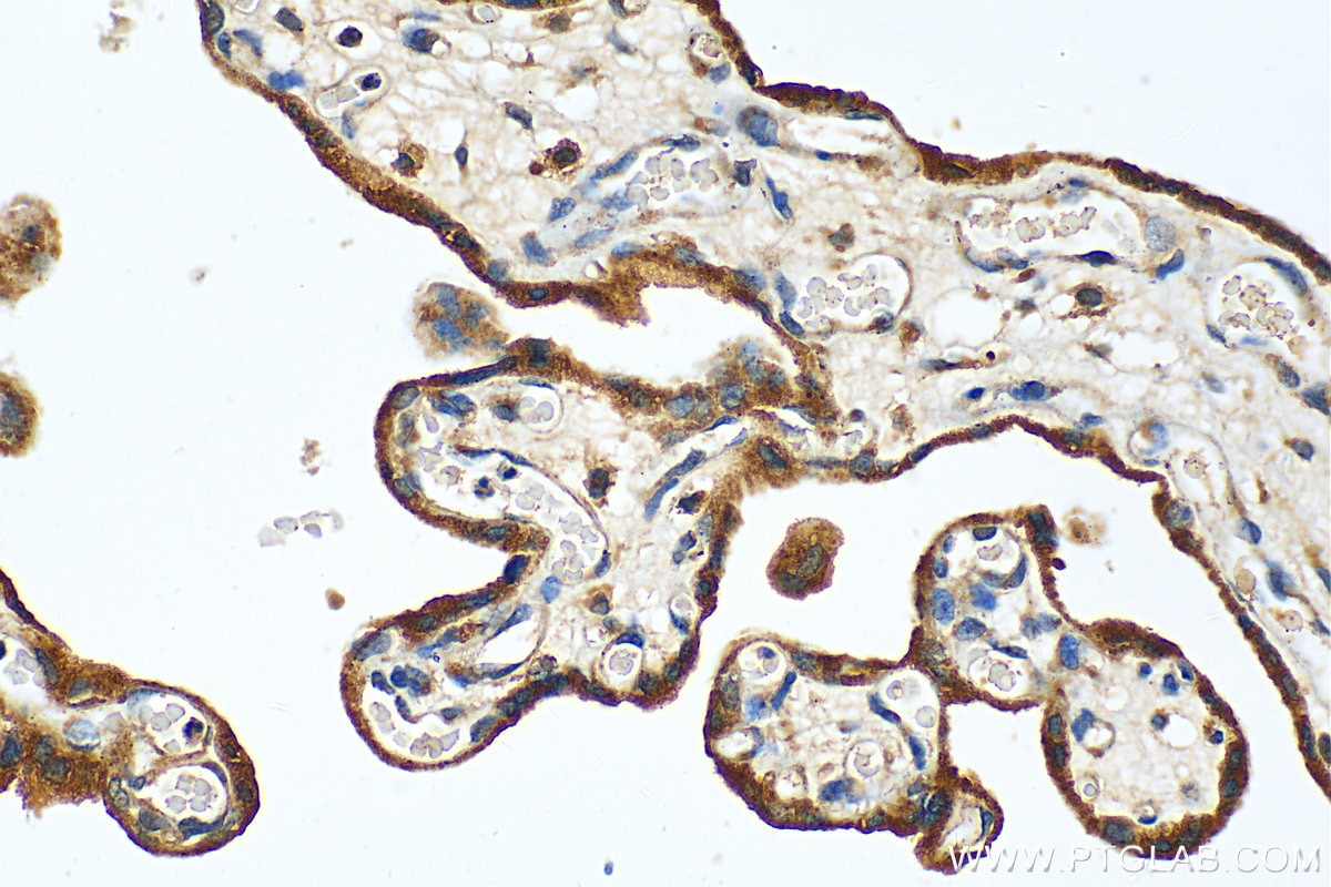 IHC staining of human placenta using 17607-1-AP
