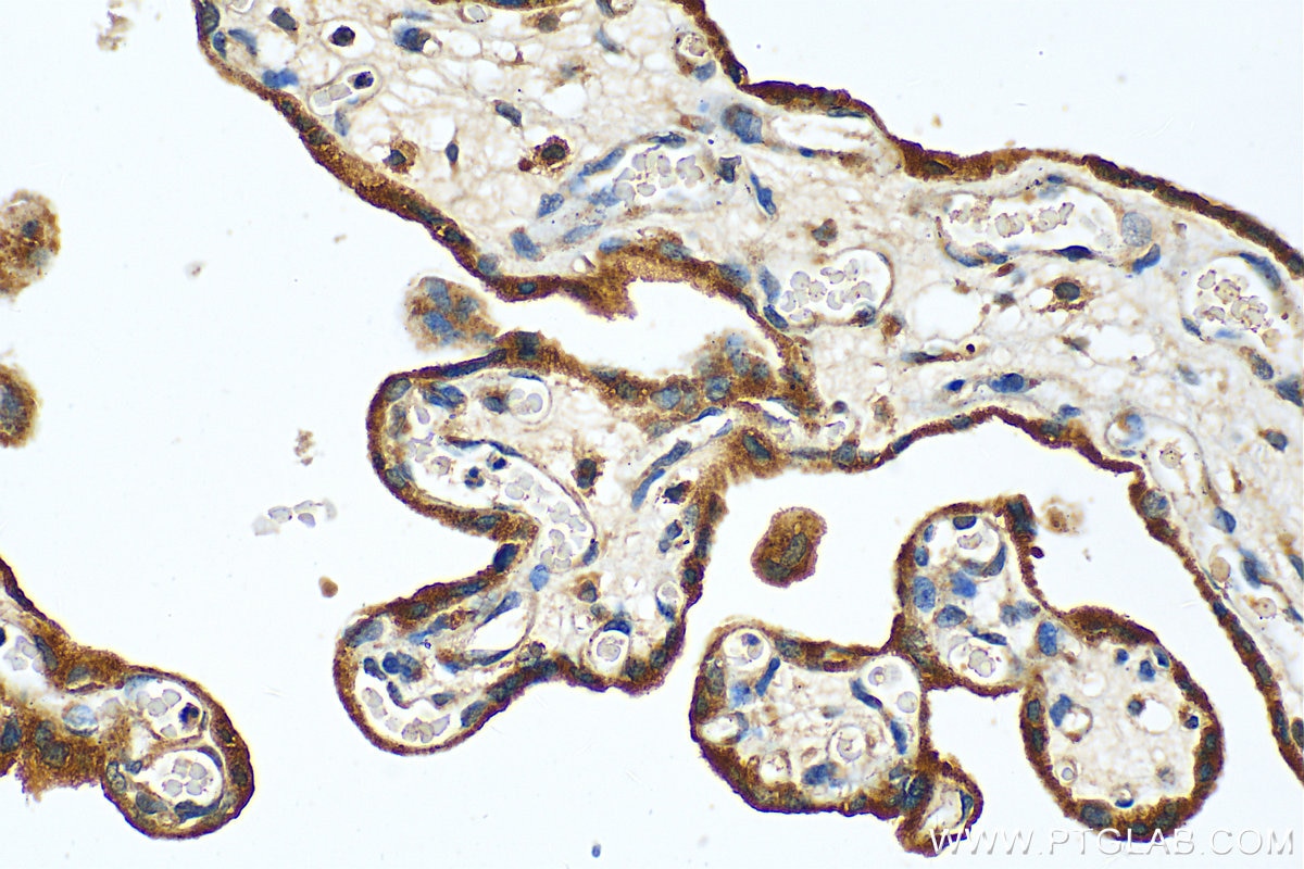 Immunohistochemistry (IHC) staining of human placenta tissue using SLC39A9 Polyclonal antibody (17607-1-AP)