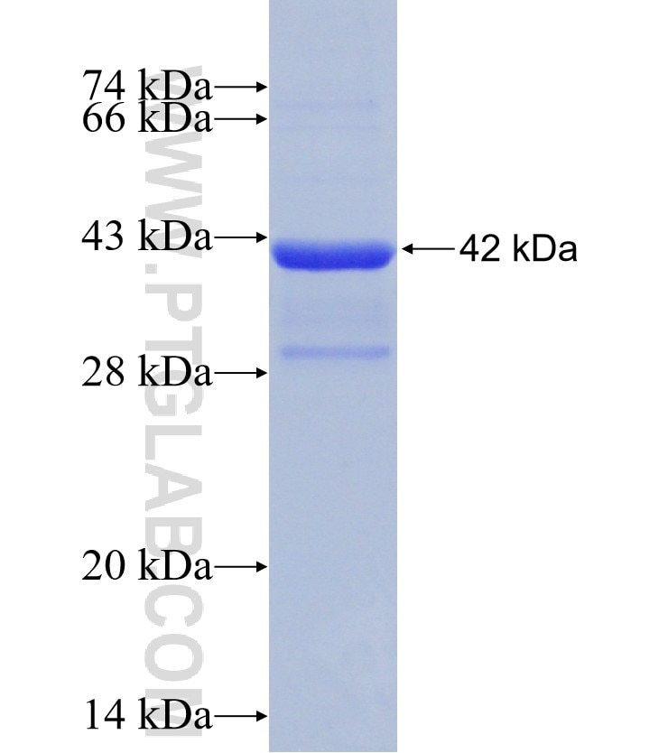 SLC39A9 fusion protein Ag11752 SDS-PAGE