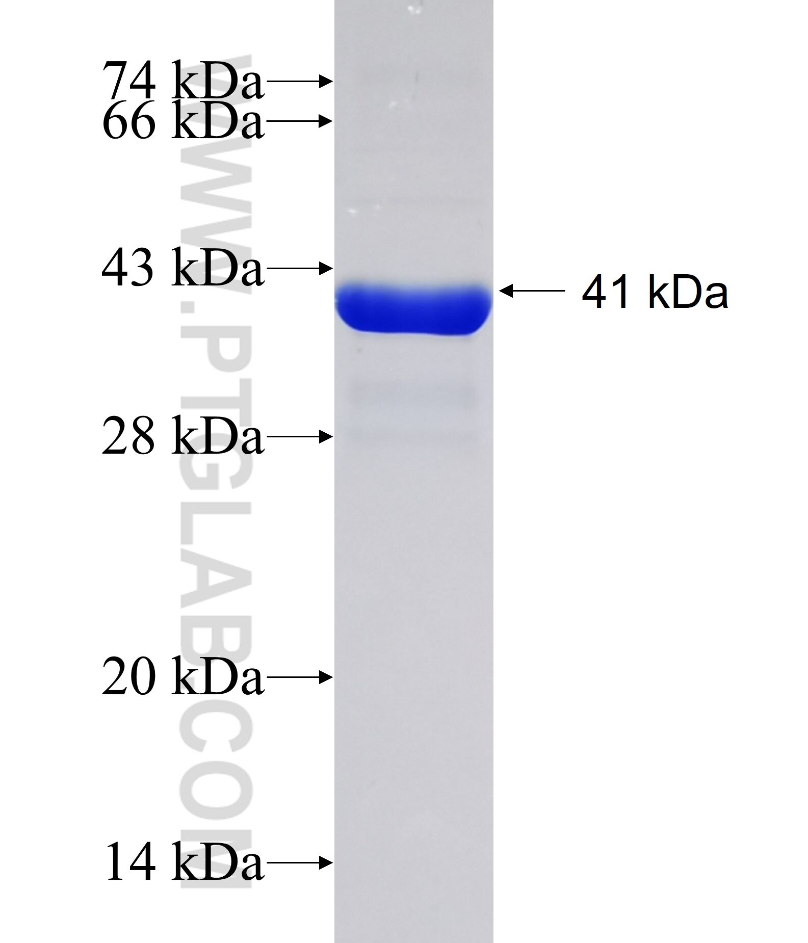 SLC39A9 fusion protein Ag11752 SDS-PAGE