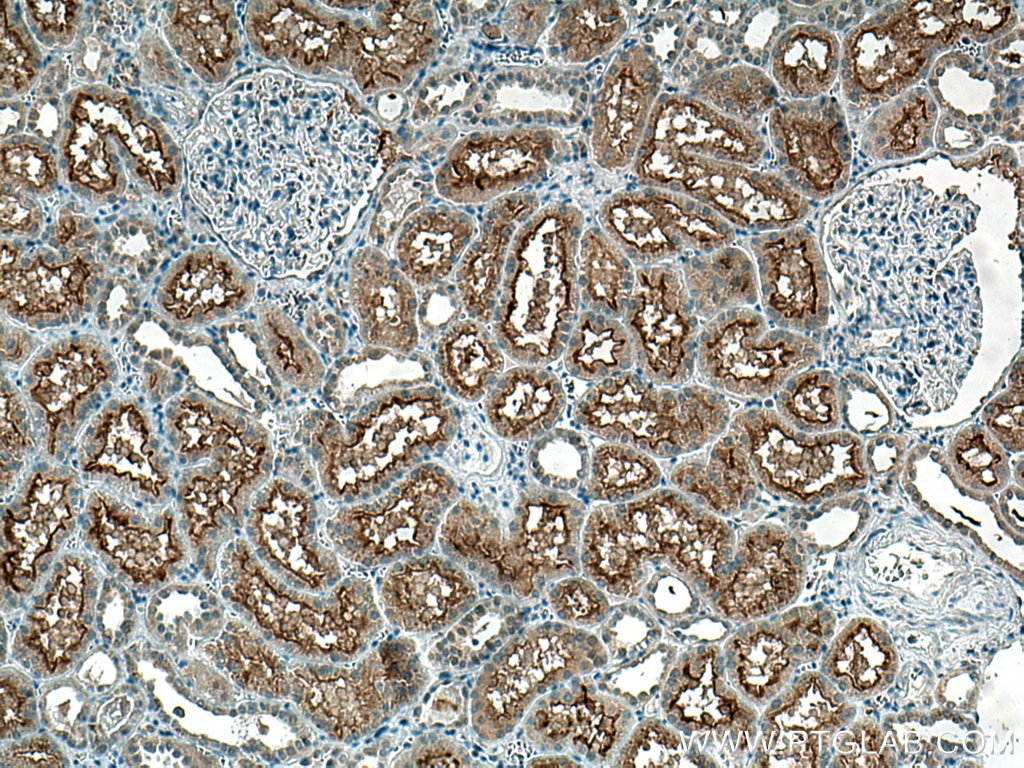 Immunohistochemistry (IHC) staining of human kidney tissue using SLC3A1 Polyclonal antibody (16343-1-AP)