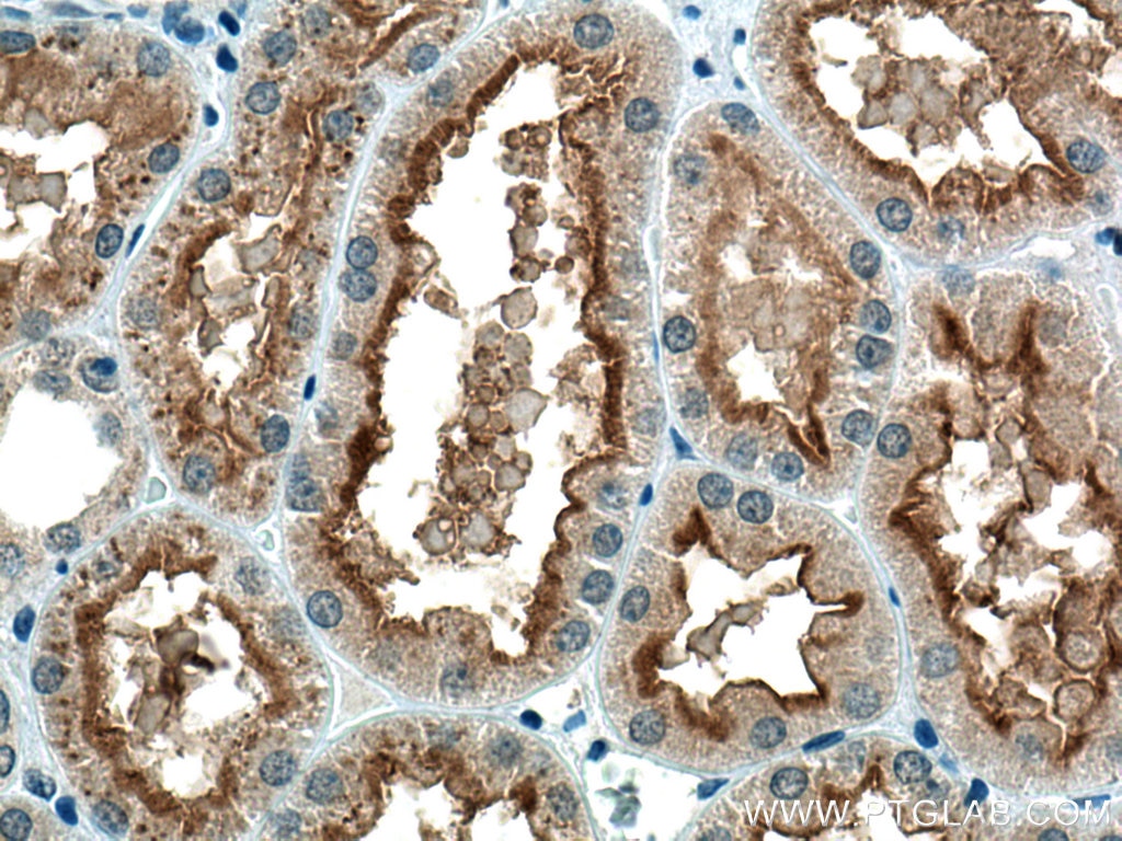 Immunohistochemistry (IHC) staining of human kidney tissue using SLC3A1 Polyclonal antibody (16343-1-AP)