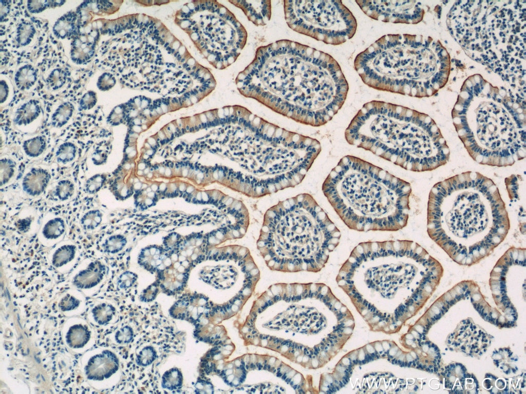 Immunohistochemistry (IHC) staining of human small intestine tissue using SLC3A1 Polyclonal antibody (16343-1-AP)