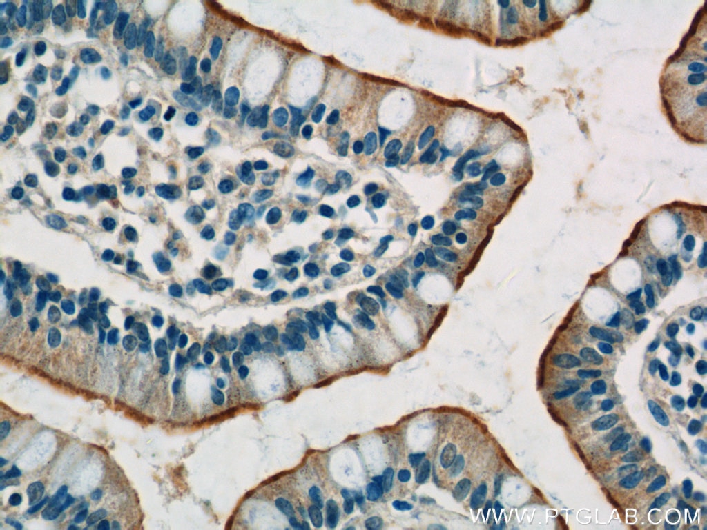 Immunohistochemistry (IHC) staining of human small intestine tissue using SLC3A1 Polyclonal antibody (16343-1-AP)