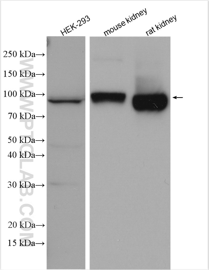 Western Blot (WB) analysis of various lysates using SLC3A1 Polyclonal antibody (16343-1-AP)