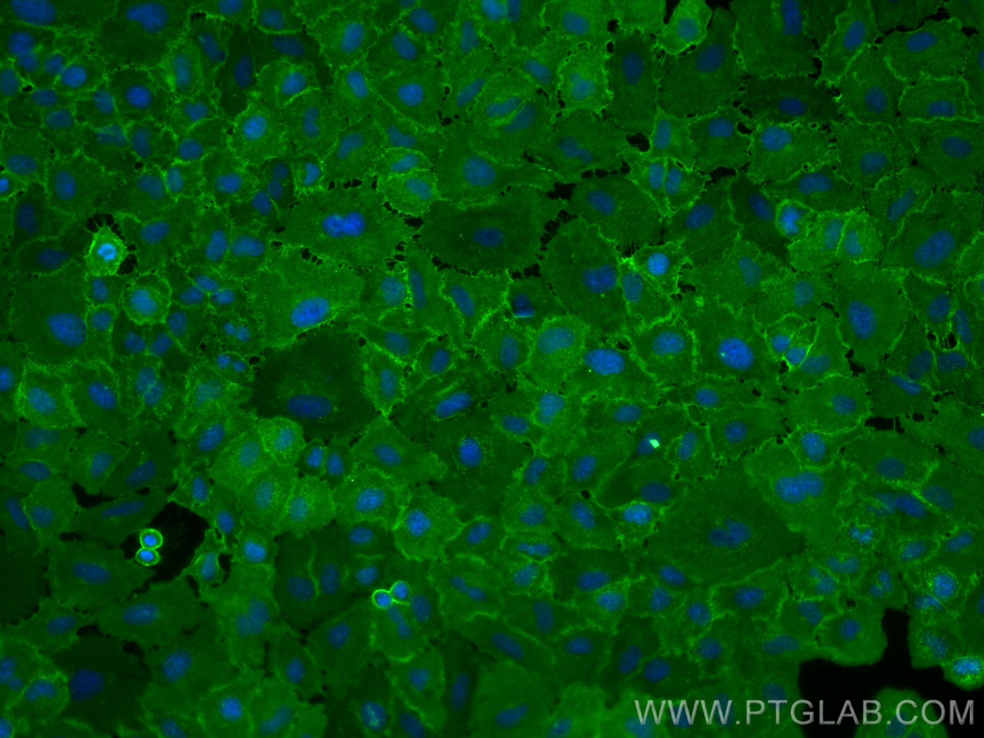 Immunofluorescence (IF) / fluorescent staining of A549 cells using CD98/SLC3A2 Polyclonal antibody (15193-1-AP)