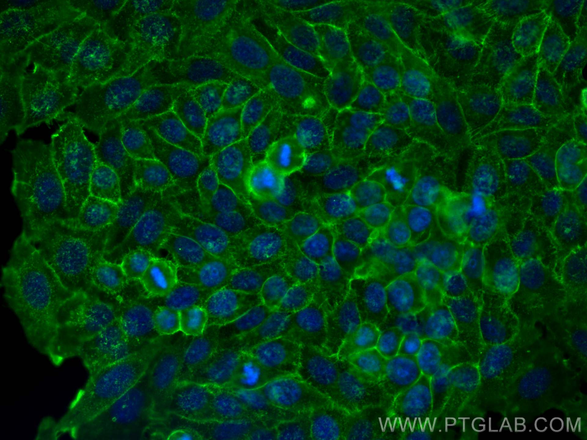 Immunofluorescence (IF) / fluorescent staining of HepG2 cells using CD98/SLC3A2 Polyclonal antibody (15193-1-AP)
