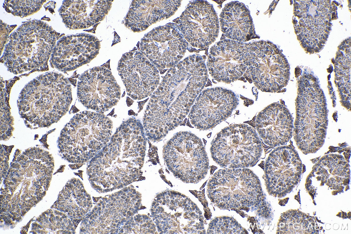 Immunohistochemistry (IHC) staining of mouse testis tissue using CD98/SLC3A2 Polyclonal antibody (15193-1-AP)