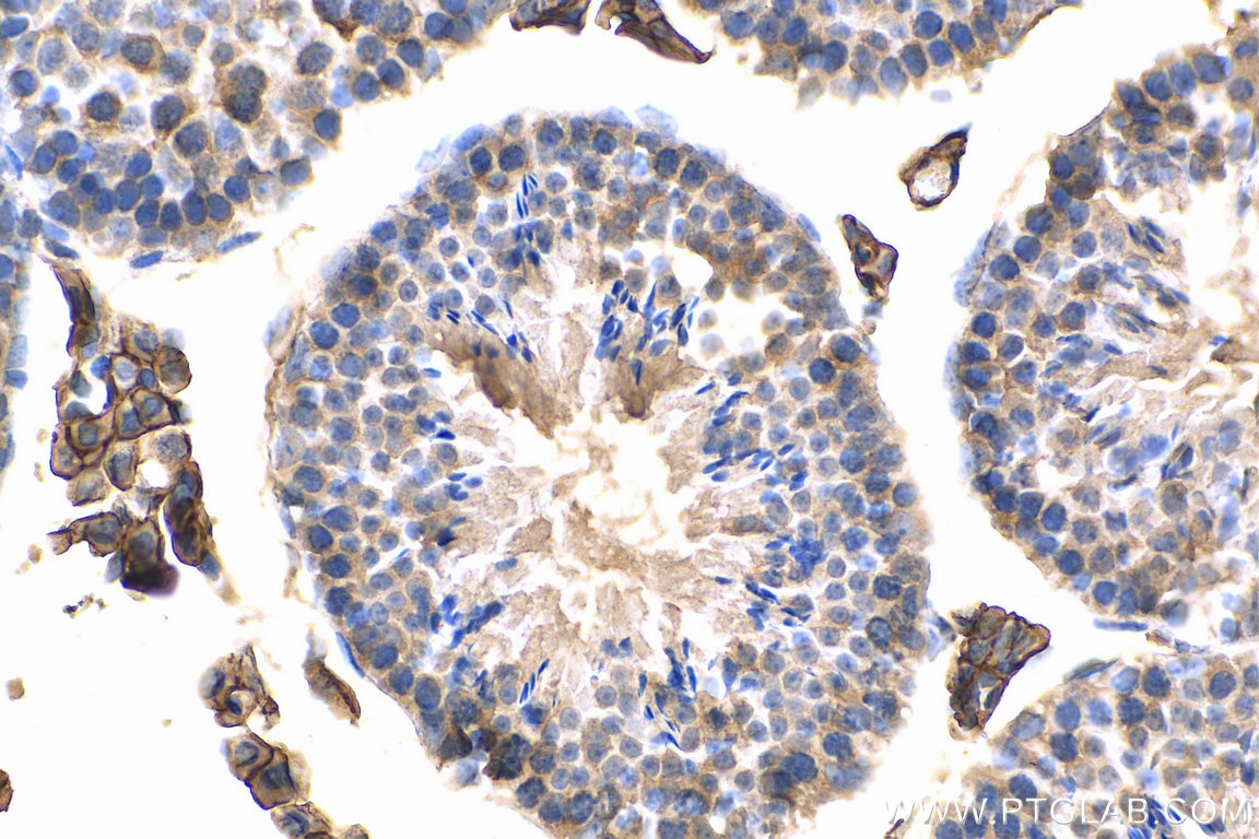 IHC staining of mouse testis using 15193-1-AP