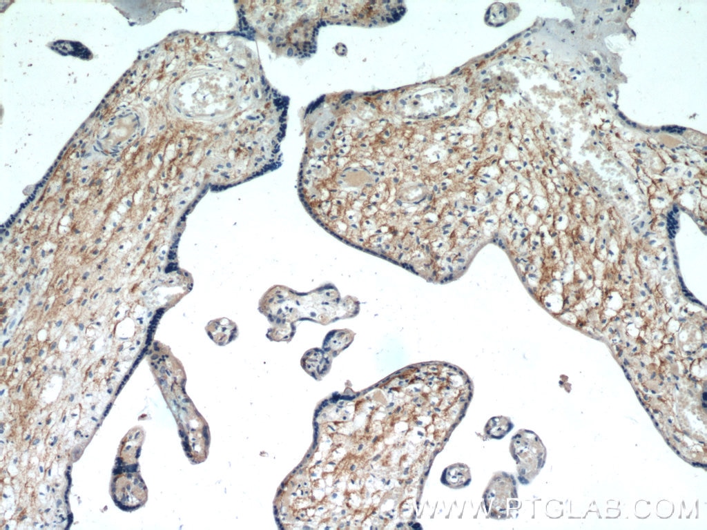Immunohistochemistry (IHC) staining of human placenta tissue using CD98/SLC3A2 Polyclonal antibody (15193-1-AP)