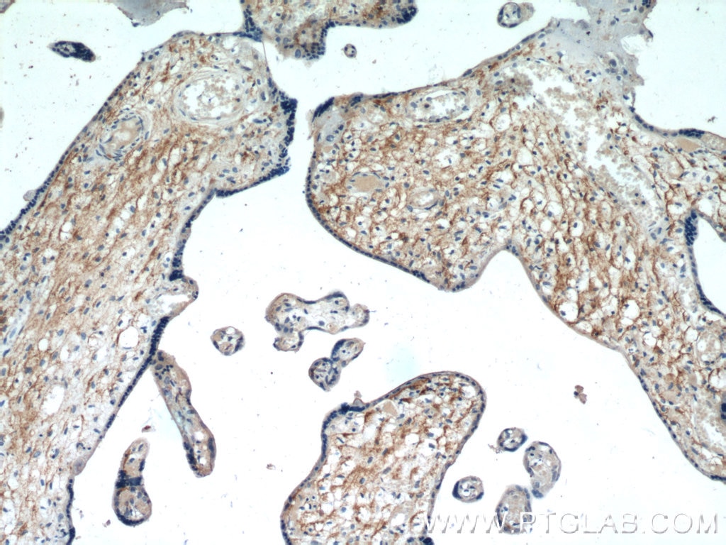 IHC staining of human placenta using 15193-1-AP