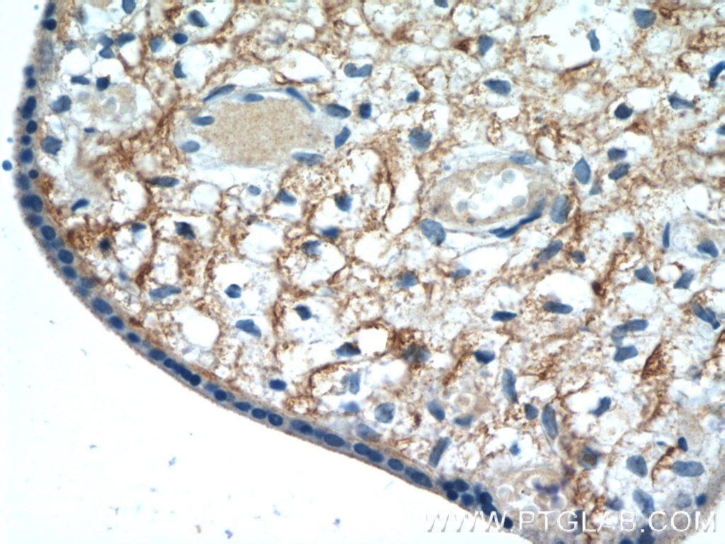 Immunohistochemistry (IHC) staining of human placenta tissue using CD98/SLC3A2 Polyclonal antibody (15193-1-AP)