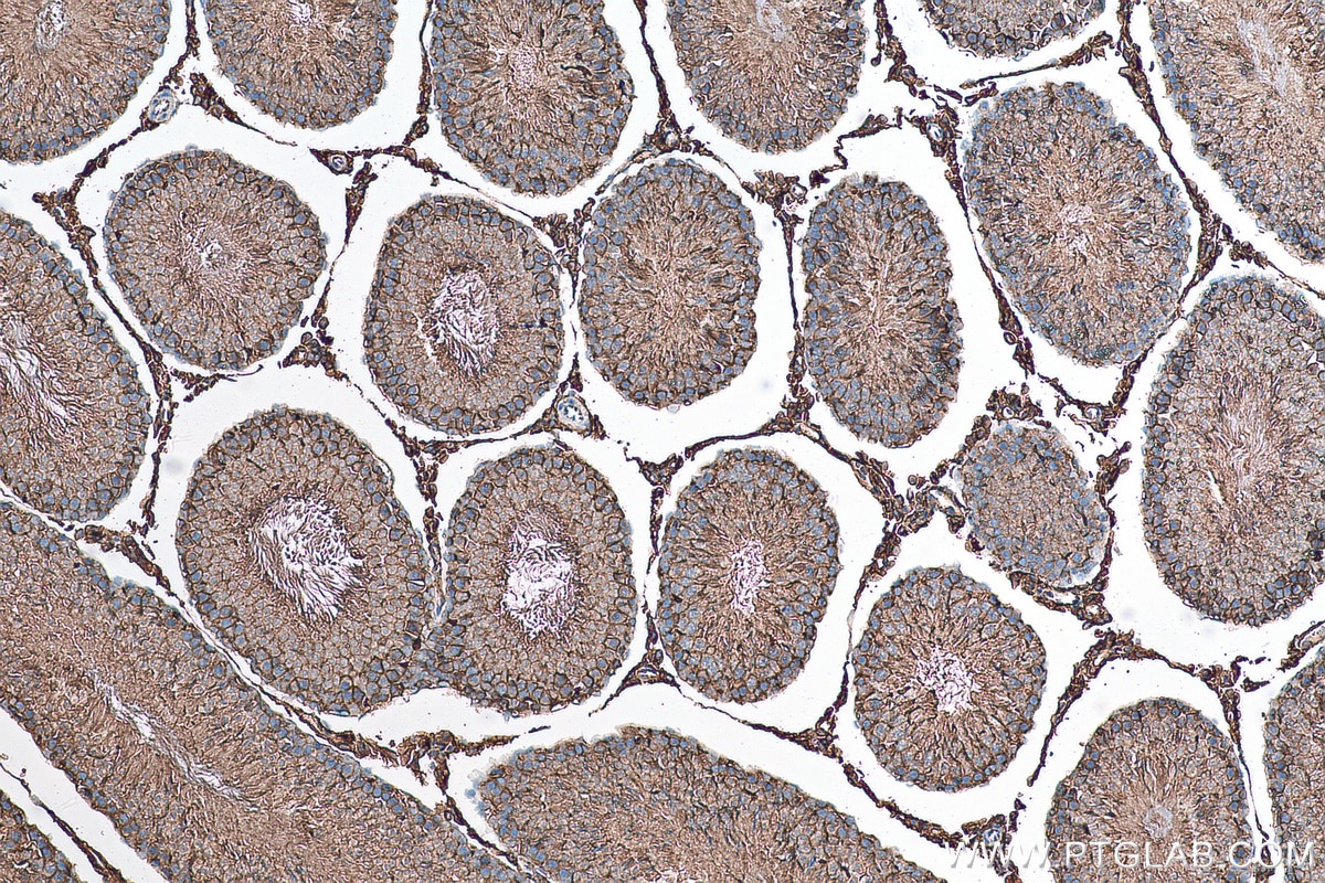 Immunohistochemistry (IHC) staining of rat testis tissue using CD98/SLC3A2 Polyclonal antibody (15193-1-AP)