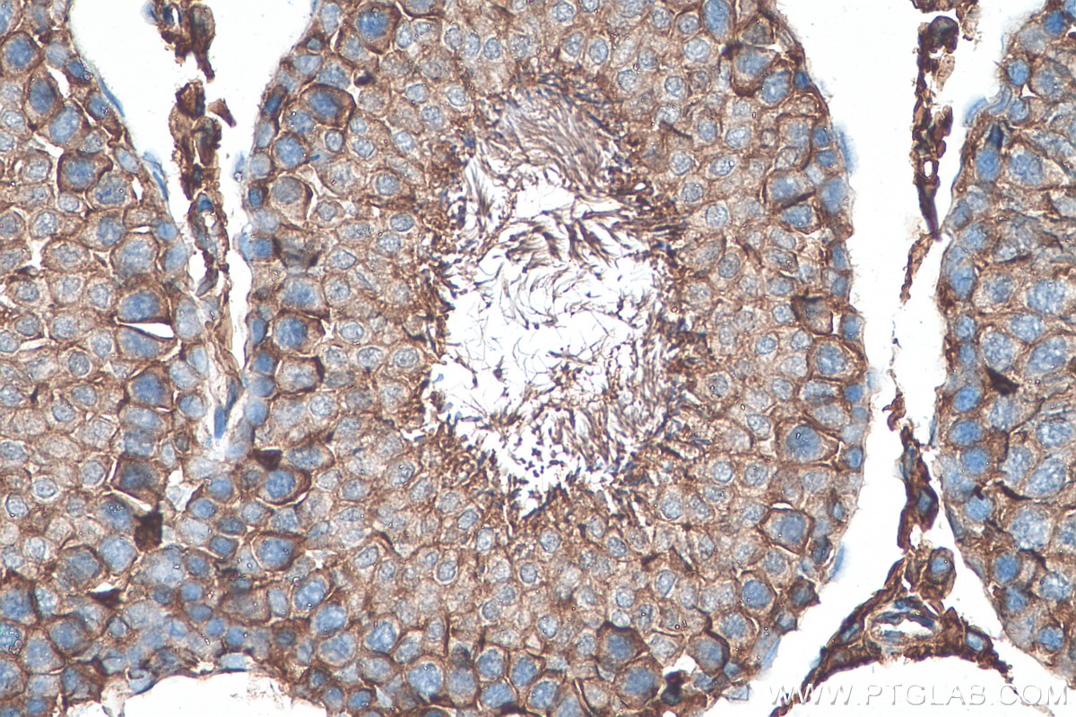 Immunohistochemistry (IHC) staining of rat testis tissue using CD98/SLC3A2 Polyclonal antibody (15193-1-AP)