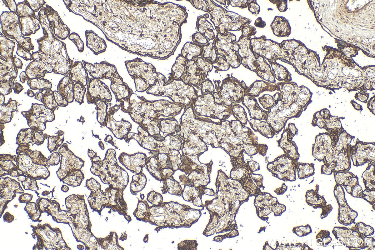 Immunohistochemistry (IHC) staining of human placenta tissue using CD98/SLC3A2 Polyclonal antibody (15193-1-AP)
