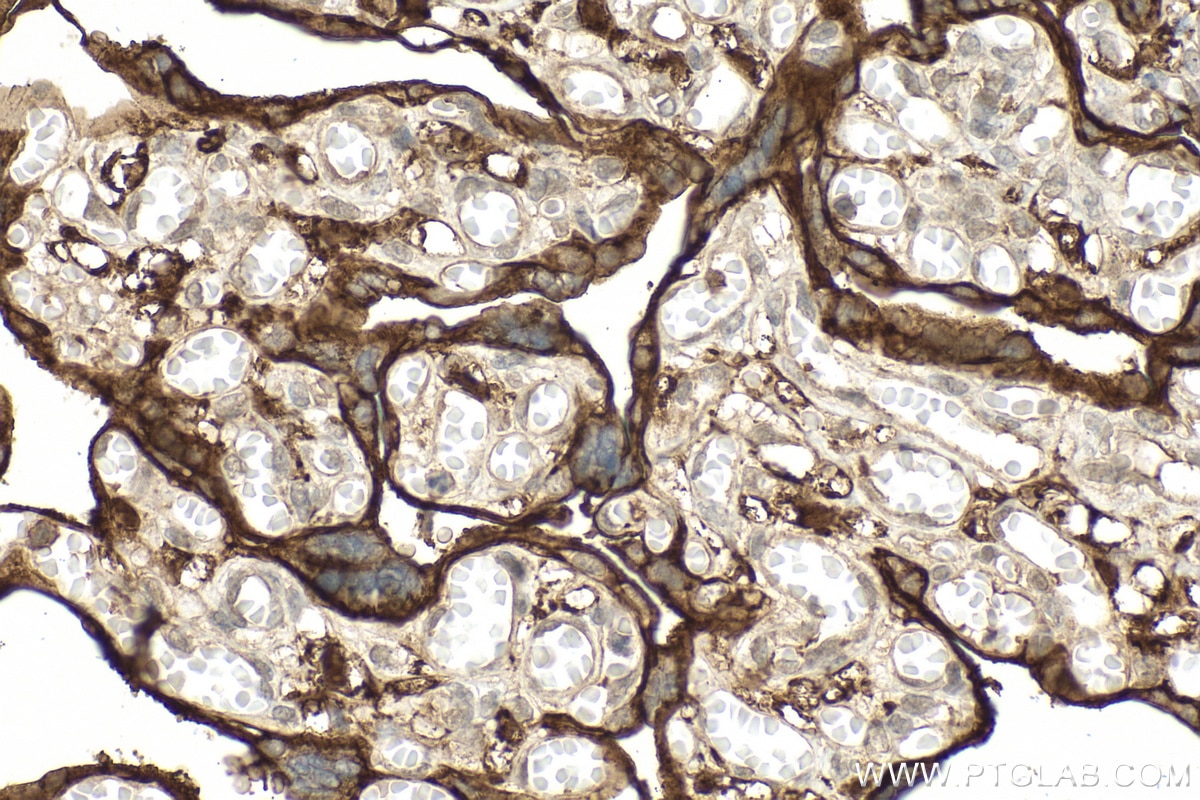 Immunohistochemistry (IHC) staining of human placenta tissue using CD98/SLC3A2 Polyclonal antibody (15193-1-AP)