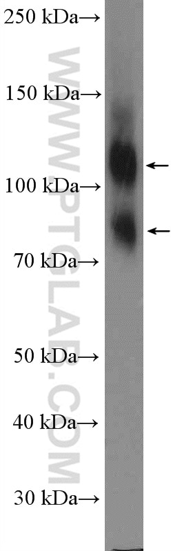 Western Blot (WB) analysis of HeLa cells using CD98/SLC3A2 Polyclonal antibody (15193-1-AP)