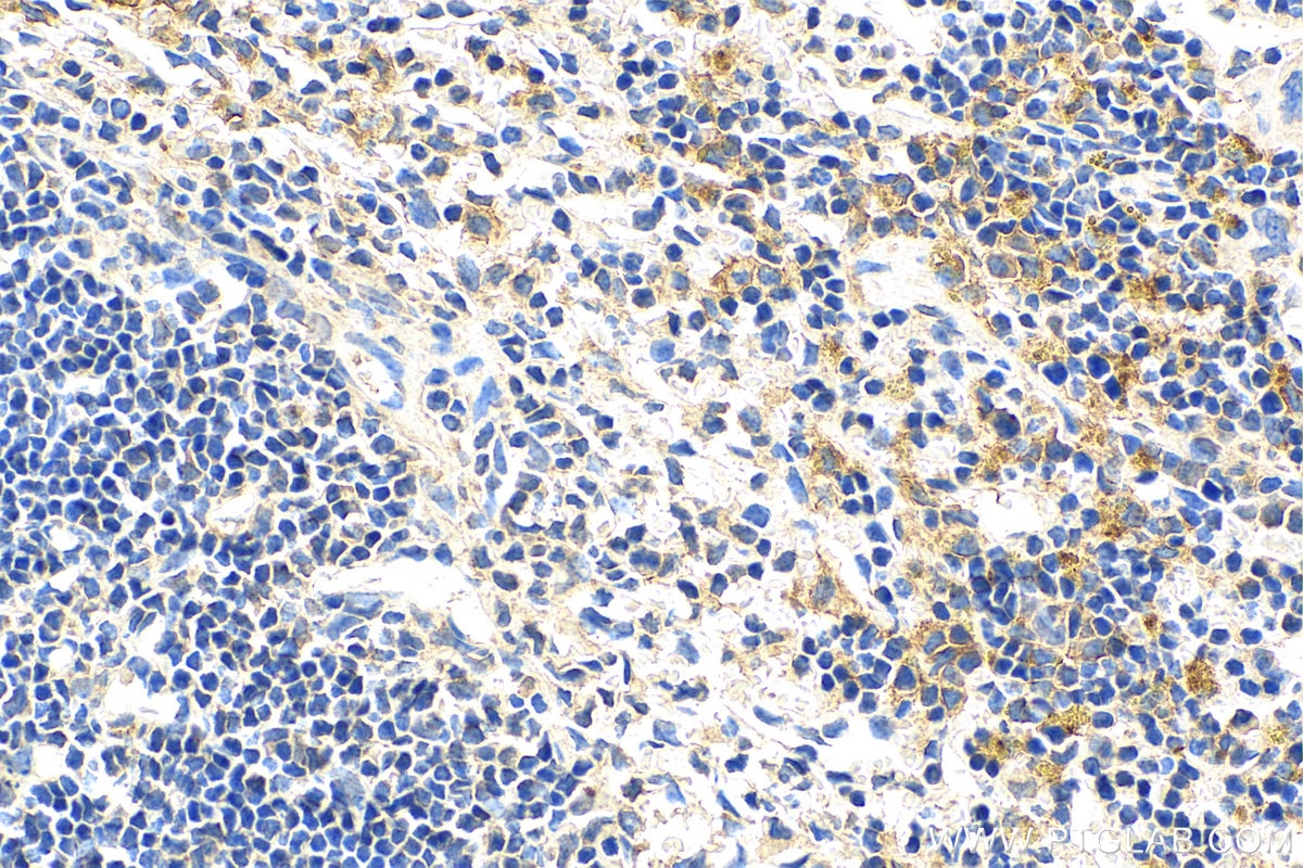 Immunohistochemistry (IHC) staining of mouse spleen tissue using SLC40A1/FPN1 Polyclonal antibody (26601-1-AP)