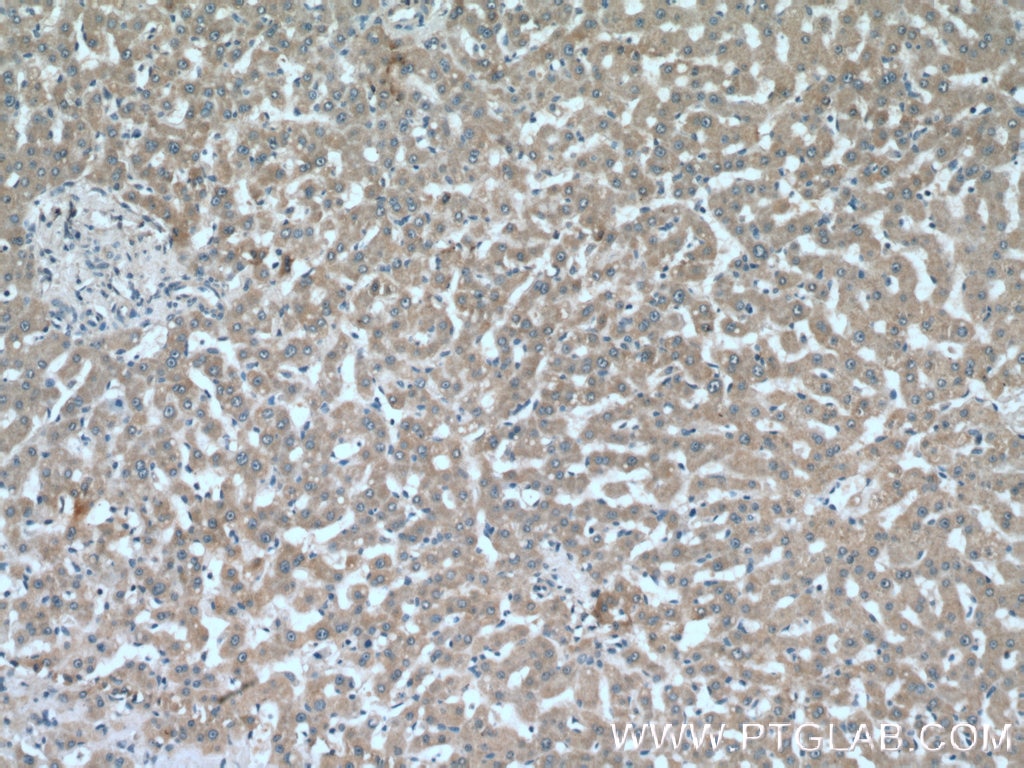 Immunohistochemistry (IHC) staining of human liver tissue using SLC40A1/FPN1 Polyclonal antibody (26601-1-AP)