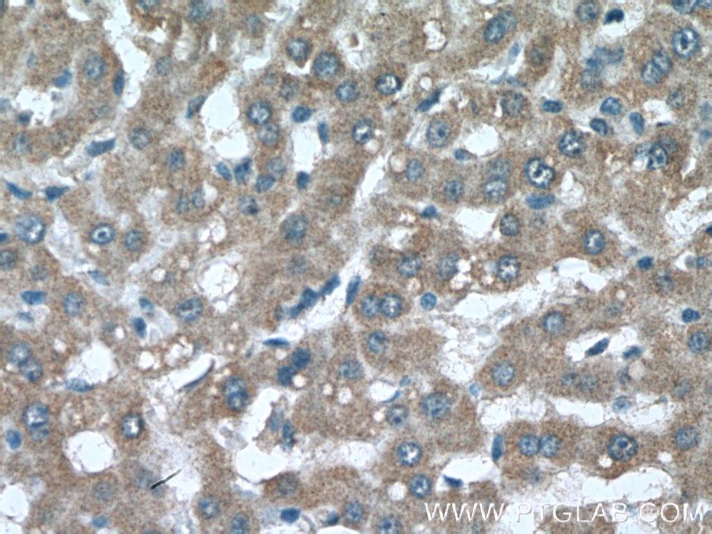 Immunohistochemistry (IHC) staining of human liver tissue using SLC40A1/FPN1 Polyclonal antibody (26601-1-AP)