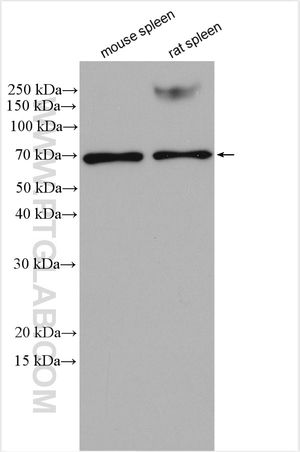 Western Blot (WB) analysis of various lysates using SLC40A1/FPN1 Polyclonal antibody (26601-1-AP)