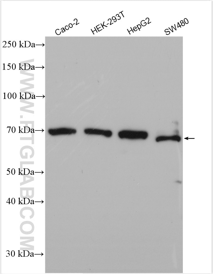 Western Blot (WB) analysis of various lysates using SLC40A1/FPN1 Polyclonal antibody (26601-1-AP)