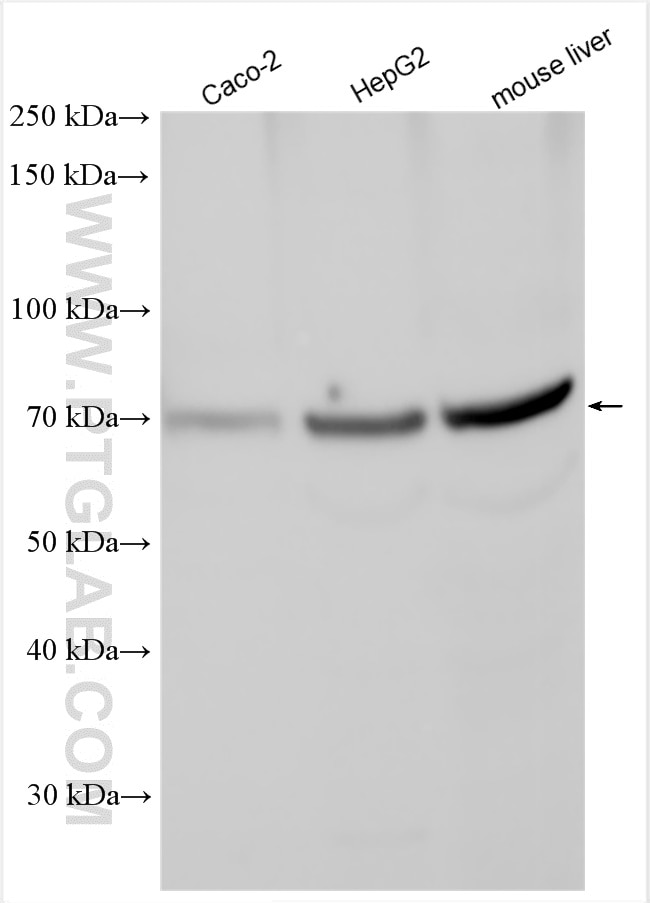 Western Blot (WB) analysis of various lysates using SLC40A1/FPN1 Polyclonal antibody (26601-1-AP)