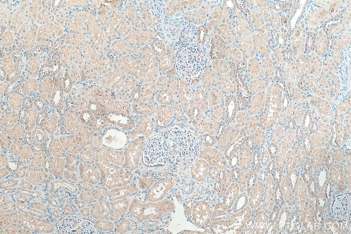 Immunohistochemistry (IHC) staining of human kidney tissue using SLC43A1 Polyclonal antibody (10444-1-AP)
